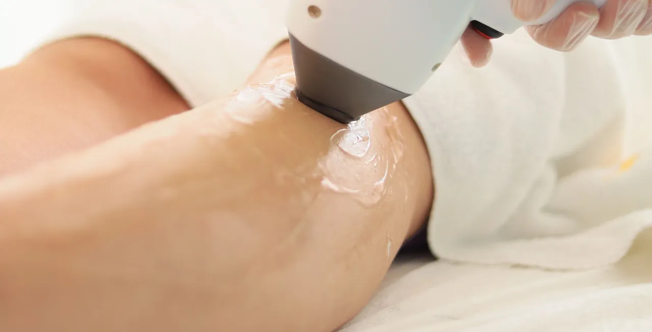Aplicación de láser sobre la piel con gel conductor.